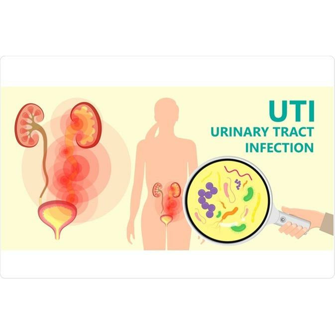 PHARMACY SERVICE: Trimethoprim Antibiotic for UTI