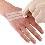 Leukostrip Skin Closures - Fairyspringspharmacy